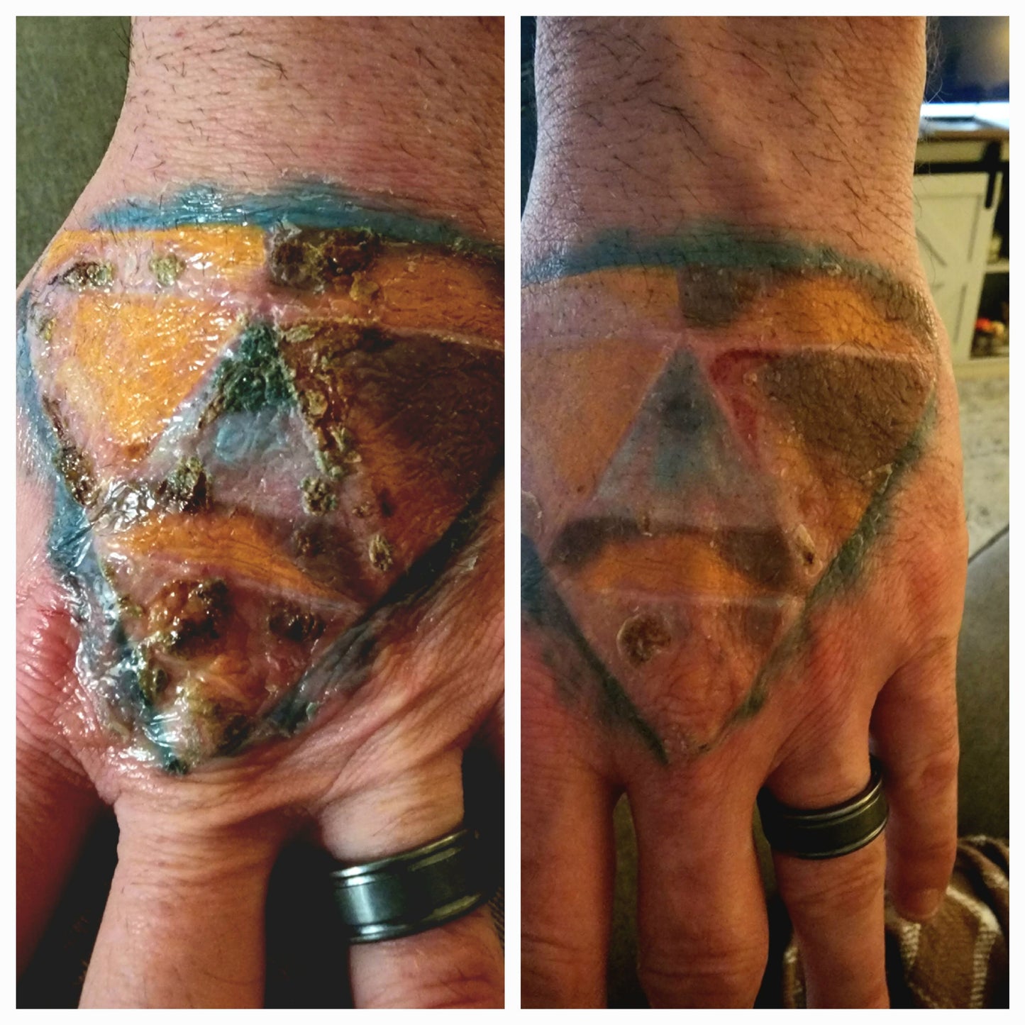 Self Heal Salve